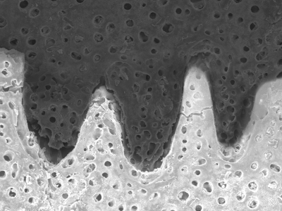 Obr. 2: Mikroskopický snímek „zámkových spojů“ destiček schránky mořského ježka