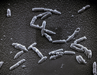 Legionella pneumophila je parazit, který vniká do lidských buněk a způsobuje tzv. legionářskou nemoc
